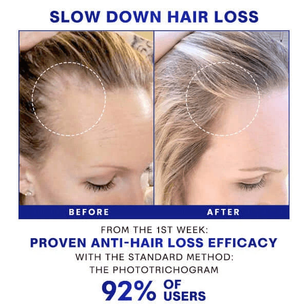 Ultra HairGrowth Formula Serum Spray