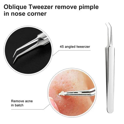 🔥HOT SALE - Professional Facial Blackhead Remover Tweezers