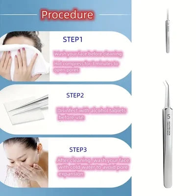 🔥HOT SALE - Professional Facial Blackhead Remover Tweezers