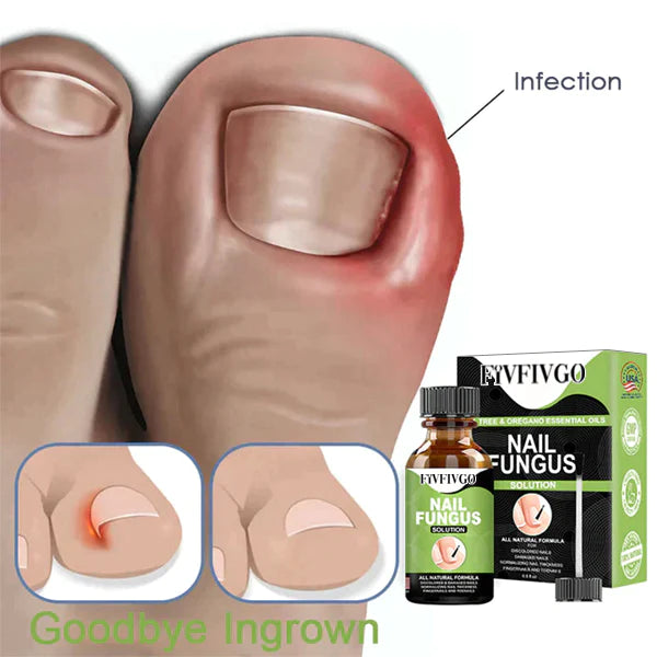 Fivfivgo™ FootCure Gel zur Entfernung von Paronychie