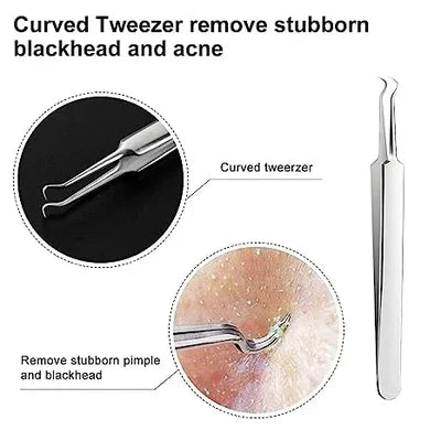 🔥HOT SALE - Professional Facial Blackhead Remover Tweezers