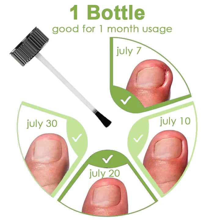 Voilaist™ Removal Paronychia Gel (Fungal infections, ingrown nail, discolored or damaged nails)🔥(Limited time discount Last 30 minutes)