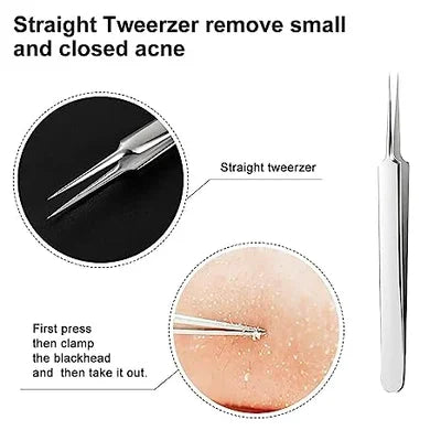 🔥HOT SALE - Professional Facial Blackhead Remover Tweezers