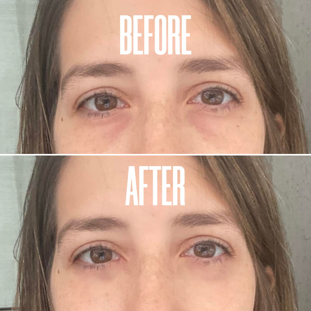 WOW-IT Instant Under-Eye Cream